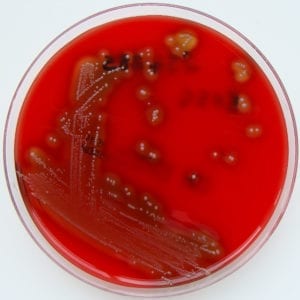 Streptococcus pyogenes on blood agar plate