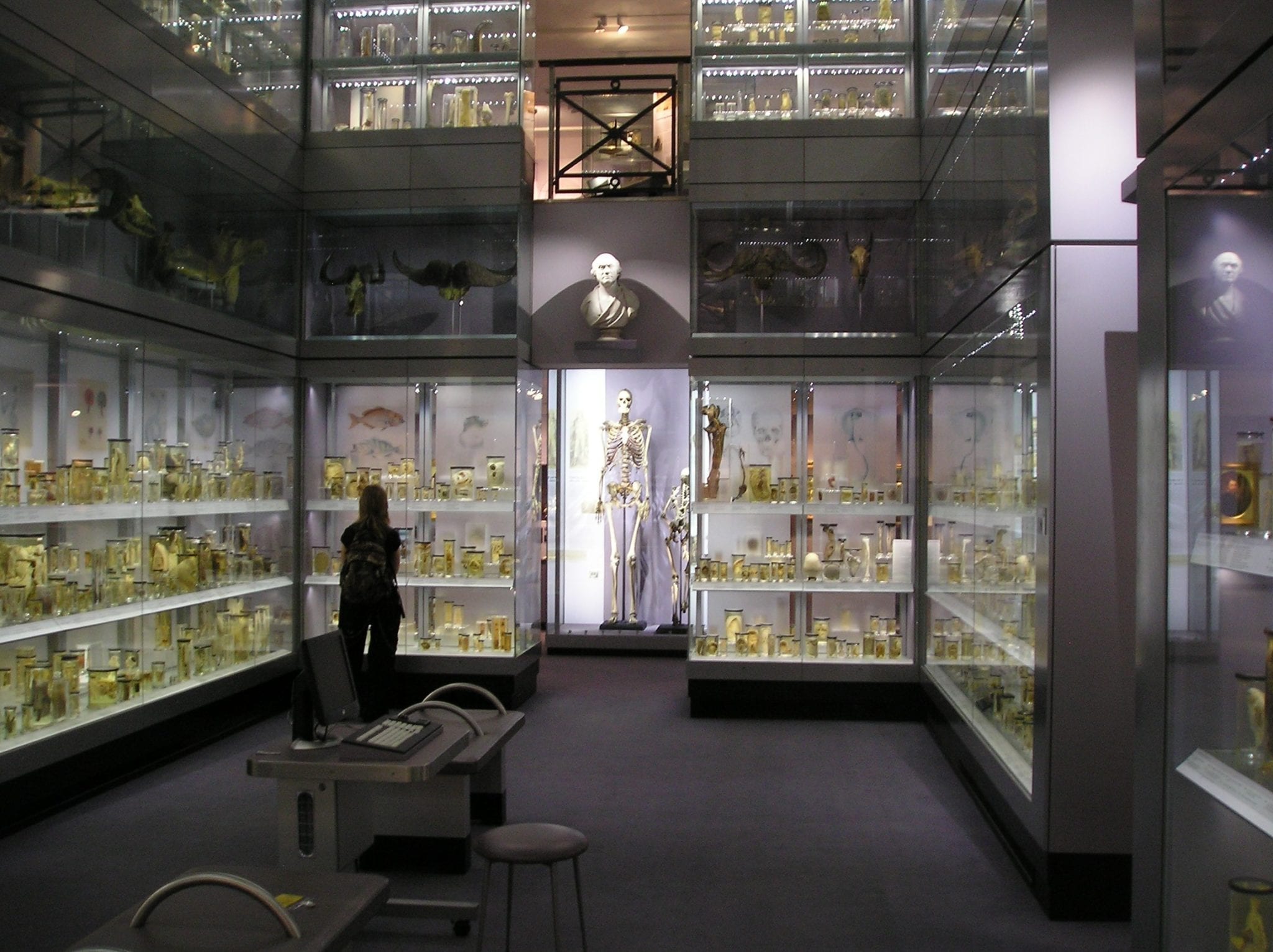 Photo of the Skeleton of the Irish Giant, who had acromegaly, in the Hunterian Museum