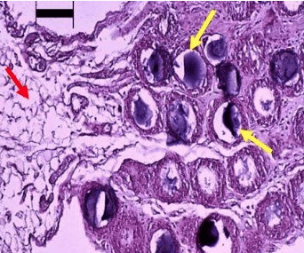Histology of activated omentum