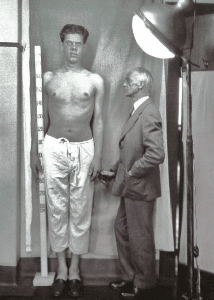 Harvey Cushing and a patient with probable gigantism