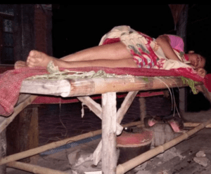 Patient on traditional Isaan sick bed
