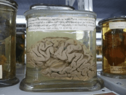 Brain studied by Broca