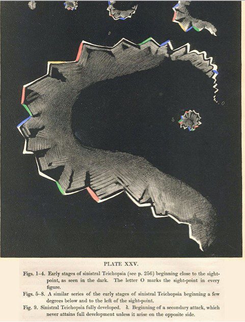 Hubert Airy's illustration of migraine aura