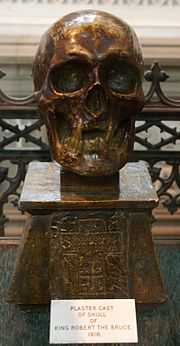 A bronze colored skull on a podium bearing a cross. A label says the cast is from 1818. For article on Robert the Bruce leprosy