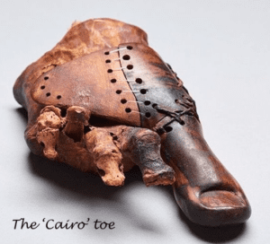 Frontal mummified foot with toe bones and with leather patches sewn together, which hold a wooden big toe in place. Caption reads "The 'Cairo' toe".