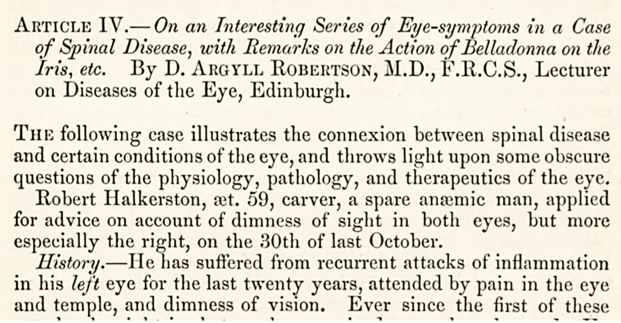 Text reads: "ARTICLE IV.—On an Interesting Series of Eye-symptoms in a Case of Spinal Disease, with Remarks on the Action of Belladonna on the Iris, etc. By D. ARGYLL ROBERTSON, M.D., F.R.C.S., Lecturer on Diseases of the Eye, Edinburgh. / THE following case illustrated the connexion between spinal disease and certain conditions of the eye, and throws light upon some obscure questions of the physiology, pathology, and therapeutics of the eye. / Robert Halkerston, æt. 59, carver, a spare anæmic man, applied for advice on account of dimness of sight in both eyes, but more especially the right, on the 30th of last October. / History.—He has suffered from recurrent attacks of inflammation in his [emphasis] left [end emphasis] eye for the last twenty years, attended by pain in the eye and temple, and dimness of vision. Ever since the first of these" [text ends].