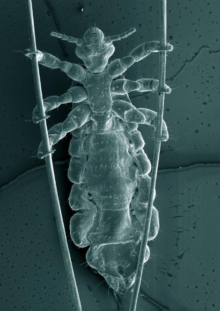 Louse with long abdomen and six legs holding onto two hairs