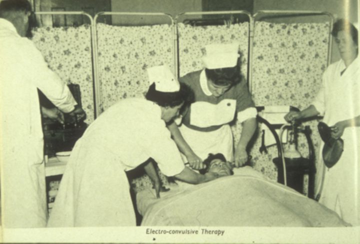 Black and white photo. A nurse holds electrodes to the sides of a presumably sedated patient's head while another seems to take his pulse, yet another waits with what may be the anesthesia, and a doctor prepares to apply the voltage